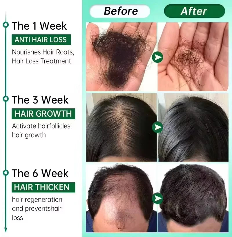 Fast Hair Growth Serum Spray anti Hair Loss Prevent Baldness Scalp Treatment Repair Roots Beauty Health Hair Care for Men Women