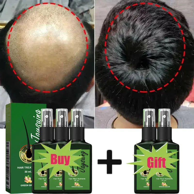 Fast Hair Growth Serum Spray anti Hair Loss Prevent Baldness Scalp Treatment Repair Roots Beauty Health Hair Care for Men Women