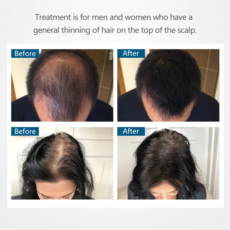 New 2025 Hair Fibers Keratin Thickening Spray Hair Building Fibers 27.5G Instant Hair Building Powders Concealer