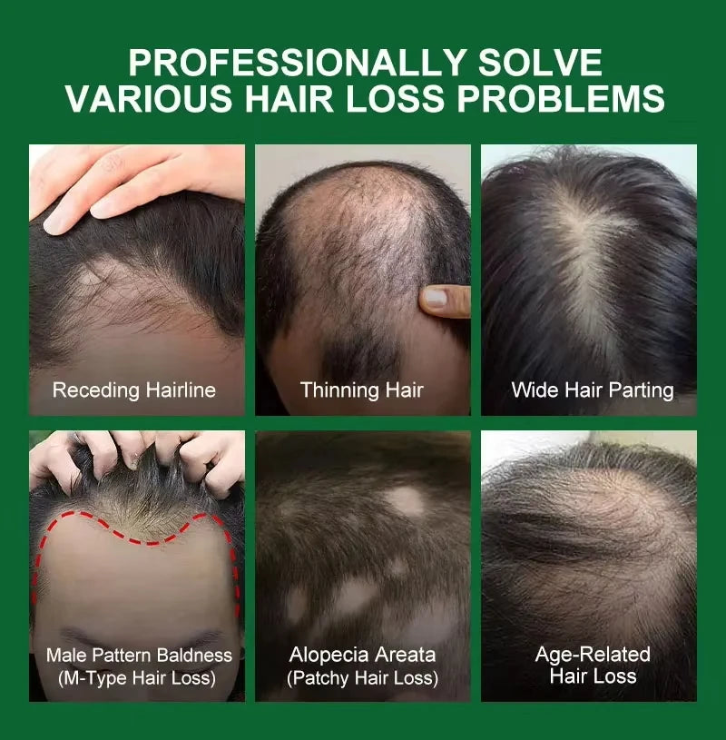 Fast Hair Growth Serum Spray anti Hair Loss Prevent Baldness Scalp Treatment Repair Roots Beauty Health Hair Care for Men Women
