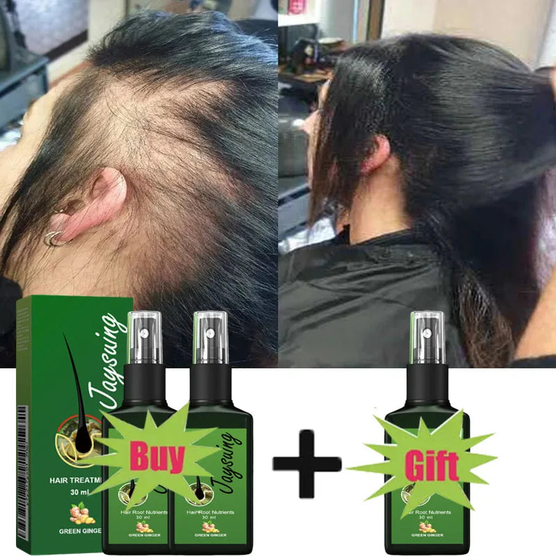 Fast Hair Growth Serum Spray anti Hair Loss Prevent Baldness Scalp Treatment Repair Roots Beauty Health Hair Care for Men Women